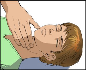 Проведение непрямого массажа сердца: техника, показания и прогноз